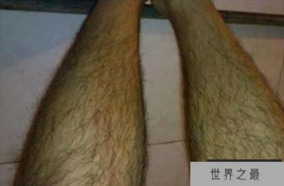 ​世界上最长的腿毛 长到了22.46厘米(杰森·艾伦)
