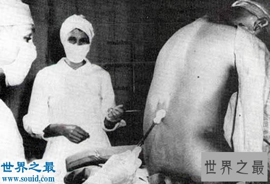 史上最骇人听闻的10个人体试验,人造连体婴儿最残忍