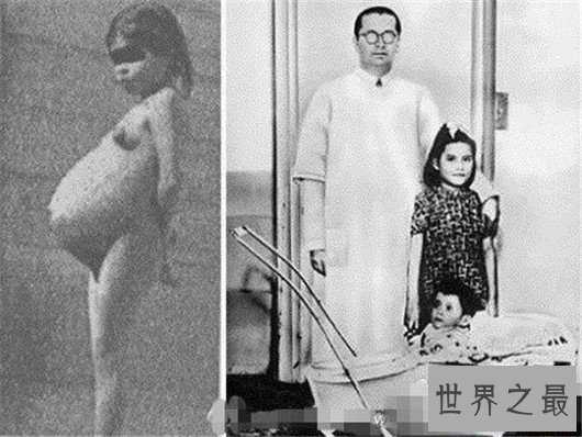 世界上最年轻的妈妈,5岁产子(8个月就来初潮)