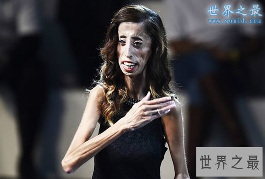 世界上最丑陋的女人,世界上20个最丑的人(怕吐勿看)