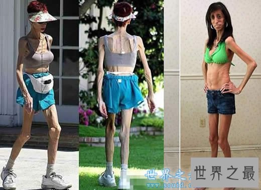 世界上最丑陋的女人,世界上20个最丑的人(怕吐勿看)