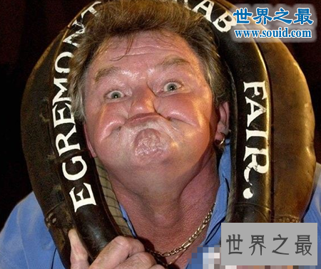 世界上最丑陋的女人,世界上20个最丑的人(怕吐勿看)