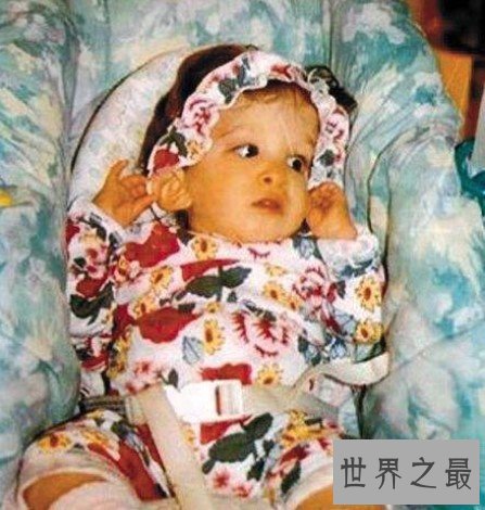 不老女婴布鲁克基因突变,身体永远停留在1岁