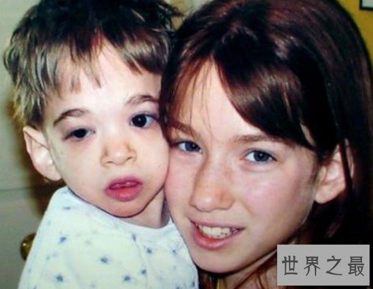 不老女婴布鲁克基因突变,身体永远停留在1岁