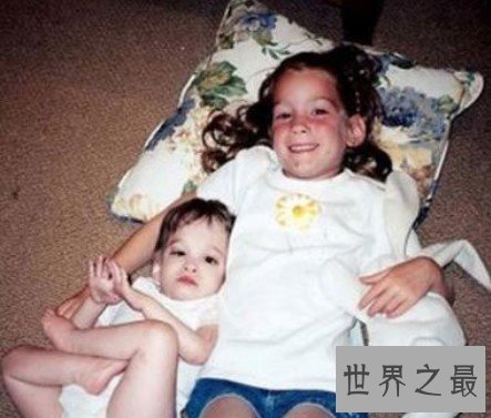 不老女婴布鲁克基因突变,身体永远停留在1岁