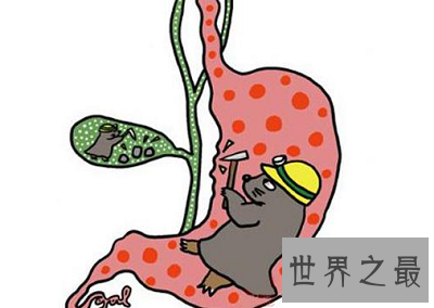 你得胆汁反流性胃炎了吗?最佳治疗方法告诉你