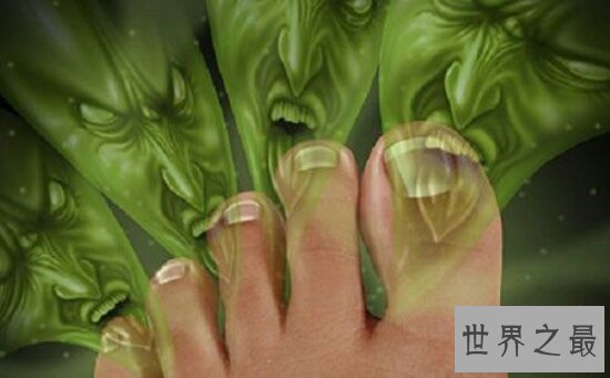 现今治脚气最有效的药 不严重别点我