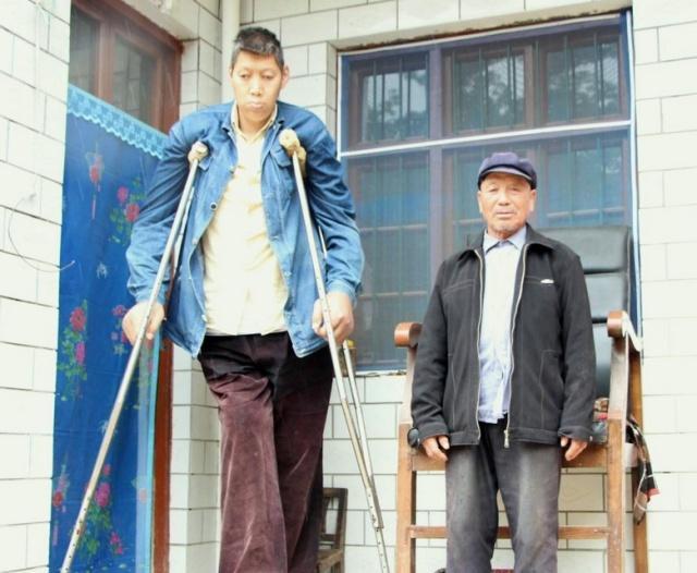 中国五大巨人:王峰军身高2.55米,排名第一