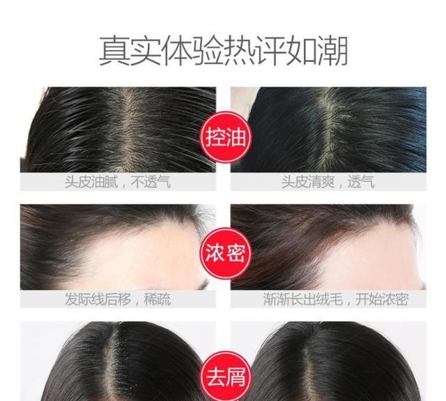 我国最“憋屈”洗发水，明明有海飞丝实力，因价格太低被人看不起