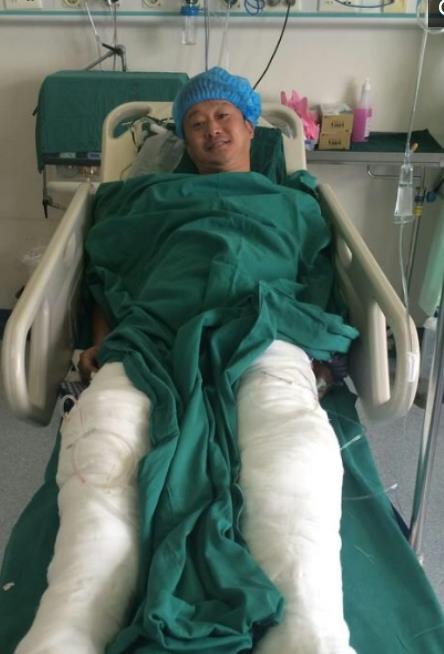 吴京的《战狼2》火了，却没人注意到他左手断掉的大拇指