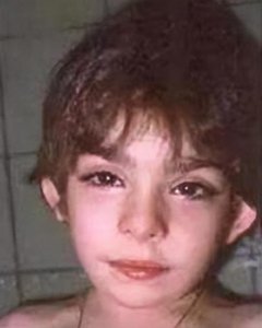 ​关注罕见病-歌舞伎综合征