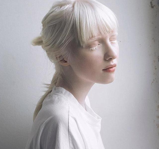 全球最美模特！上帝给了她残疾，却成就了她令人心碎的美貌