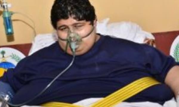 世界上最重的人排行榜(乔恩·布劳尔·明诺尼1979年达到体重巅峰值1270斤)(2)_