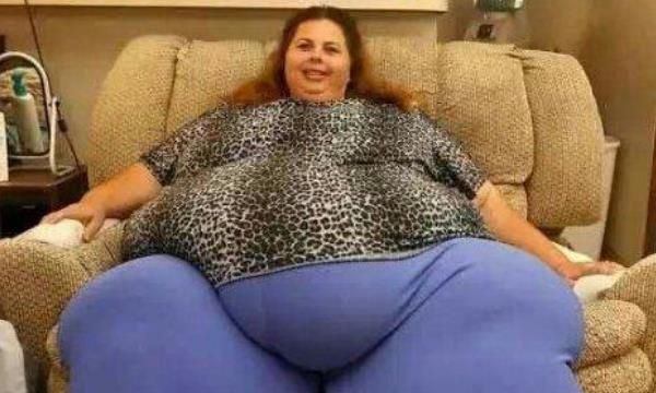 世界上最重的人排行榜(乔恩·布劳尔·明诺尼1979年达到体重巅峰值1270斤)(4)_