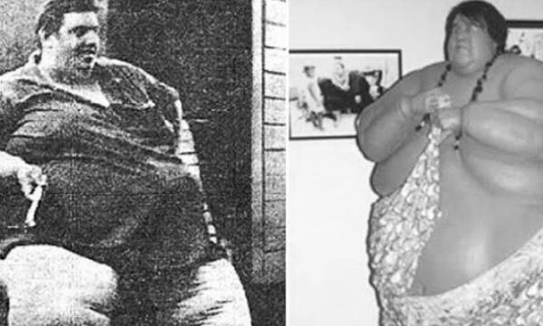 世界上最重的人排行榜(乔恩·布劳尔·明诺尼1979年达到体重巅峰值1270斤)(1)_