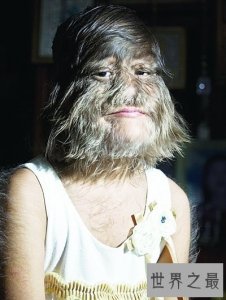 ​世界十大兽孩，那些被野兽养大的吃人孩子