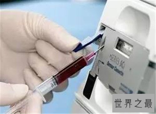 动脉血气分析是什么意思 它能提供什么样的信息