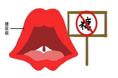 ​不吃药，光靠运动能治糖尿病吗？70岁大爷坚持运动20年，揭晓答案