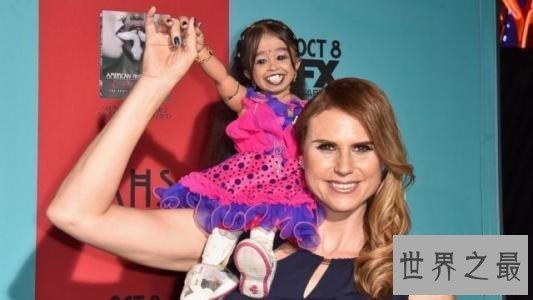 体毛最长的女人，像是穿了个吉利服。