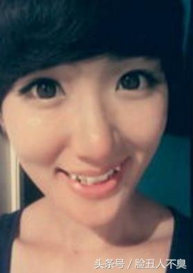 小虎牙到底是什么,是不是虎牙都是卡哇伊的尼