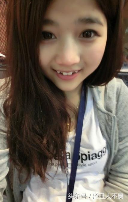 小虎牙到底是什么,是不是虎牙都是卡哇伊的尼