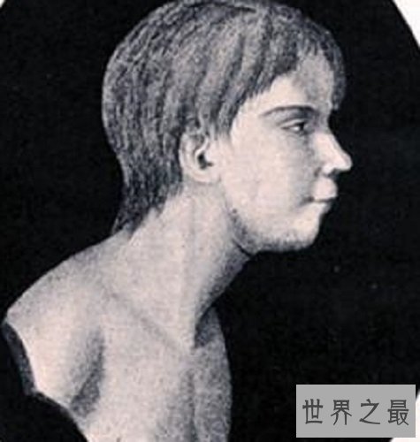 世界十大兽孩，他们的生活经历是多么的坎坷与无奈
