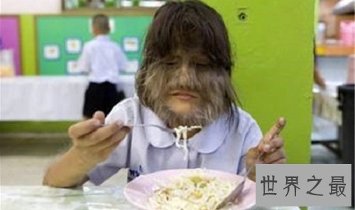 世界十大兽孩，他们的生活经历是多么的坎坷与无奈