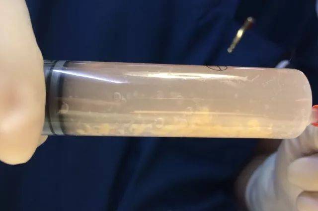 猫腹水最多能活几天(普通猫腹水可以自愈吗)