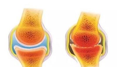 ​20岁后如何让自己长高(20岁还能长高吗?怎样才能再长高?)