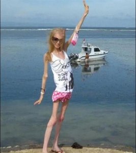 ​身高175的她，却只有20公斤，世界上最瘦的女人应该就是她了