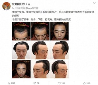 ​网友曝华晨宇整容照，还指张碧晨当小三，其实是8年老粉回踩