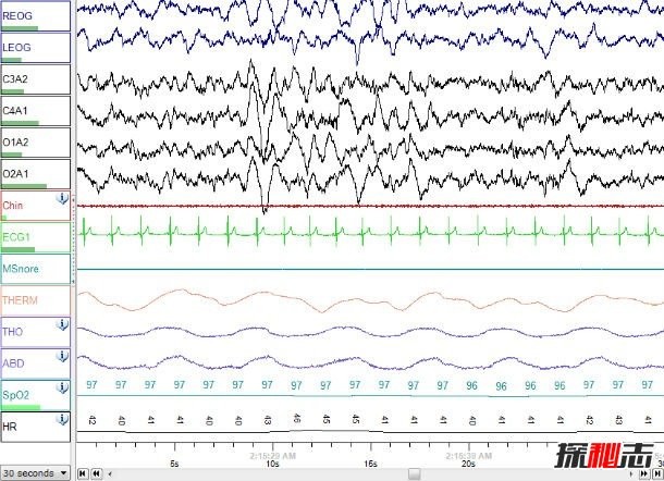 鬼压床是睡眠瘫痪?科学解释恐怖的睡眠瘫痪